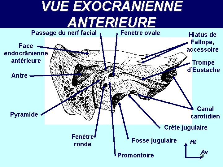 VUE EXOCR NIENNE ANTERIEURE Passage du nerf facial Fenêtre ovale Hiatus de Fallope, accessoire