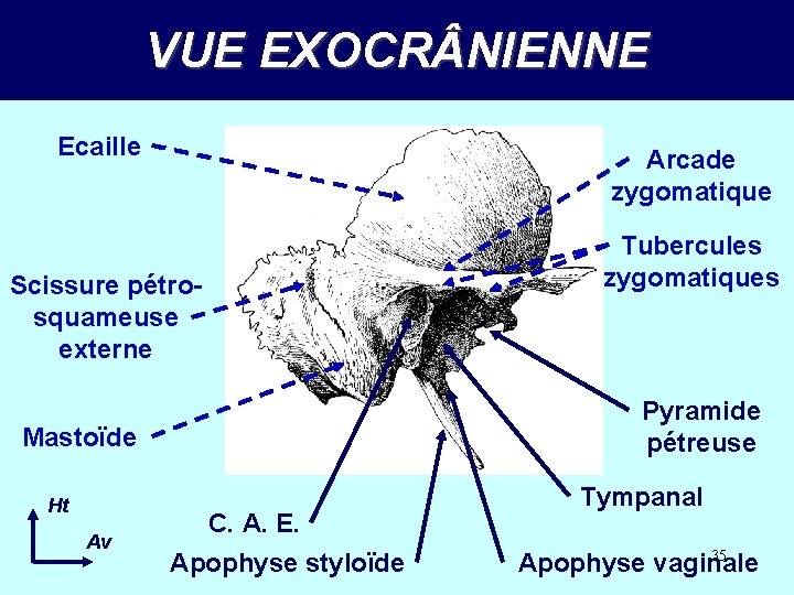 VUE EXOCR NIENNE Ecaille Arcade zygomatique Scissure pétrosquameuse externe Pyramide pétreuse Mastoïde Ht Av