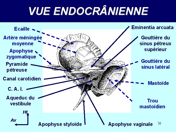 VUE ENDOCR NIENNE Eminentia arcuata Ecaille Artère méningée moyenne Apophyse zygomatique Pyramide pétreuse Canal