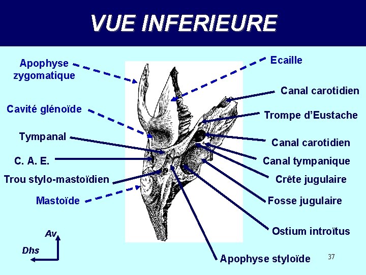 VUE INFERIEURE Apophyse zygomatique Ecaille Canal carotidien Cavité glénoïde Tympanal C. A. E. Trou