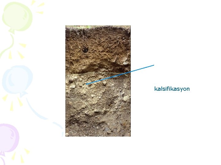 kalsifikasyon 