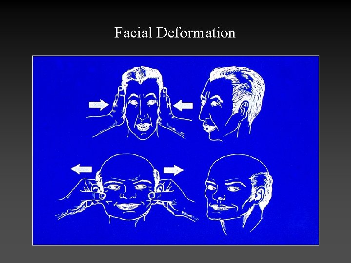 Facial Deformation 