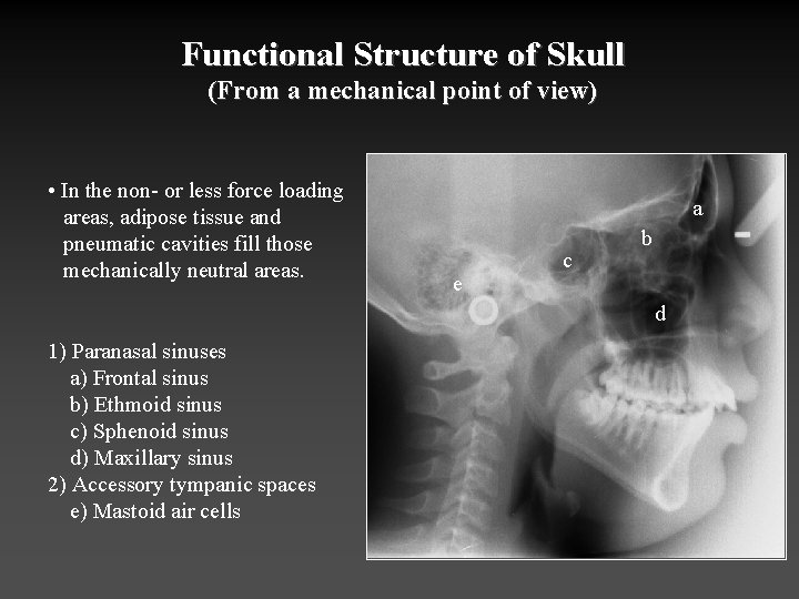 Functional Structure of Skull (From a mechanical point of view) • In the non-