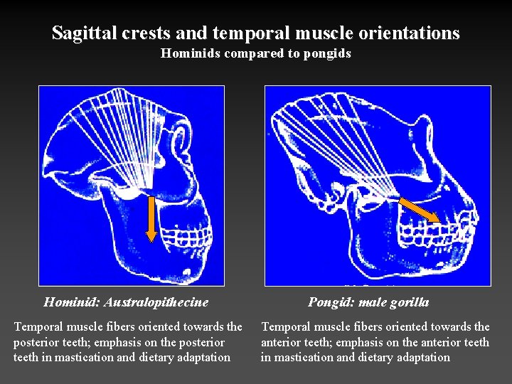 Sagittal crests and temporal muscle orientations Hominids compared to pongids Hominid: Australopithecine Temporal muscle