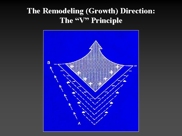 The Remodeling (Growth) Direction: The “V” Principle 