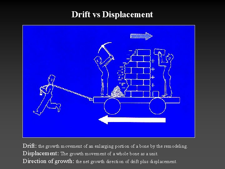 Drift vs Displacement Drift: the growth movement of an enlarging portion of a bone