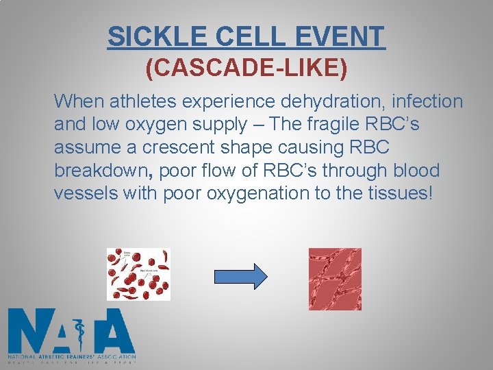 SICKLE CELL EVENT (CASCADE-LIKE) When athletes experience dehydration, infection and low oxygen supply – SICKLE CELL EVENT (CASCADE-LIKE) When athletes experience dehydration, infection and low oxygen supply –