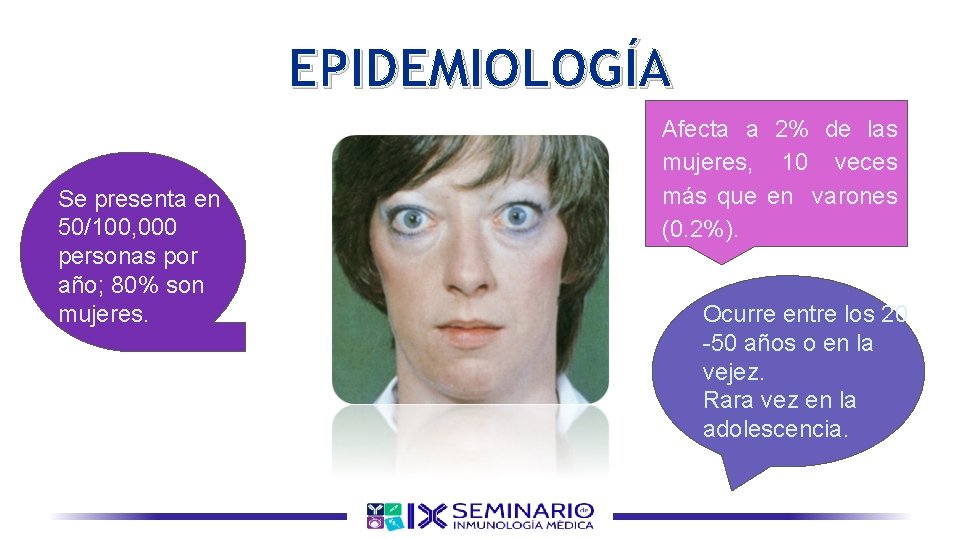 EPIDEMIOLOGÍA Se presenta en 50/100, 000 personas por año; 80% son mujeres. Afecta a