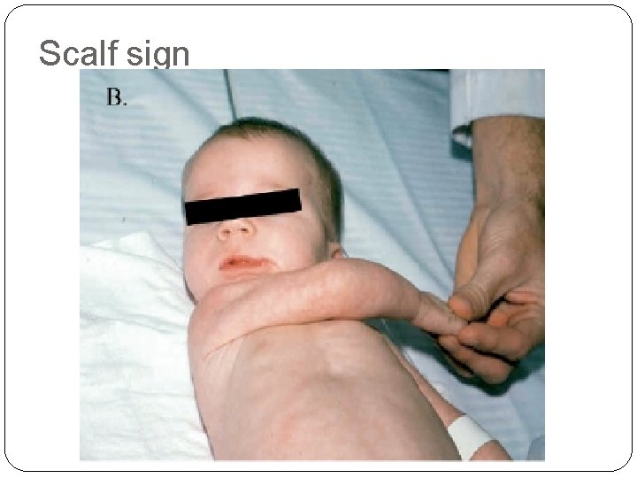 Scalf sign 