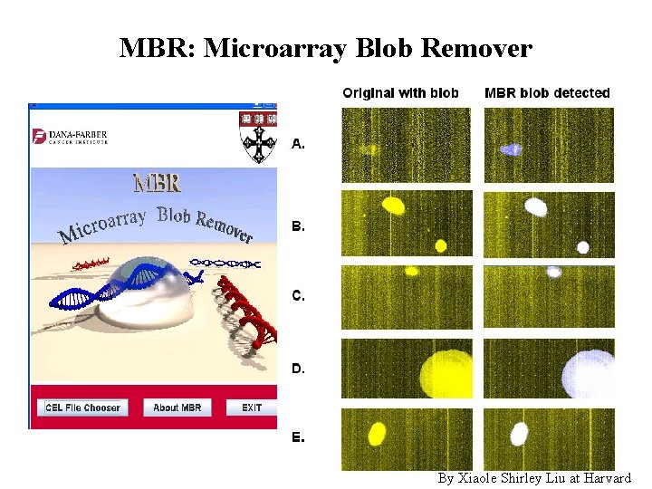 MBR: Microarray Blob Remover By Xiaole Shirley Liu at Harvard 