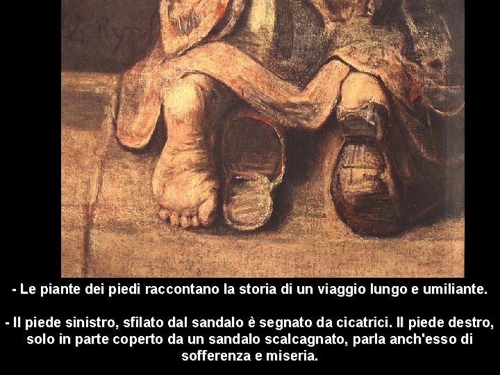 - Le piante dei piedi raccontano la storia di un viaggio lungo e umiliante. - Le piante dei piedi raccontano la storia di un viaggio lungo e umiliante.