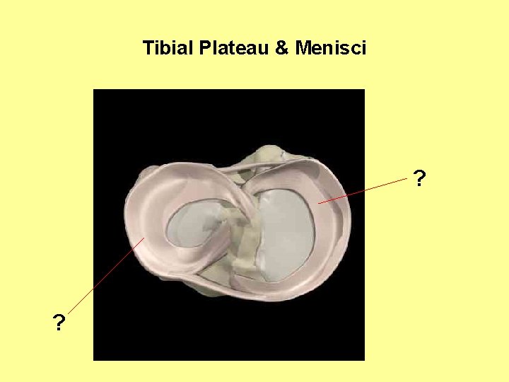Tibial Plateau & Menisci ? ? 