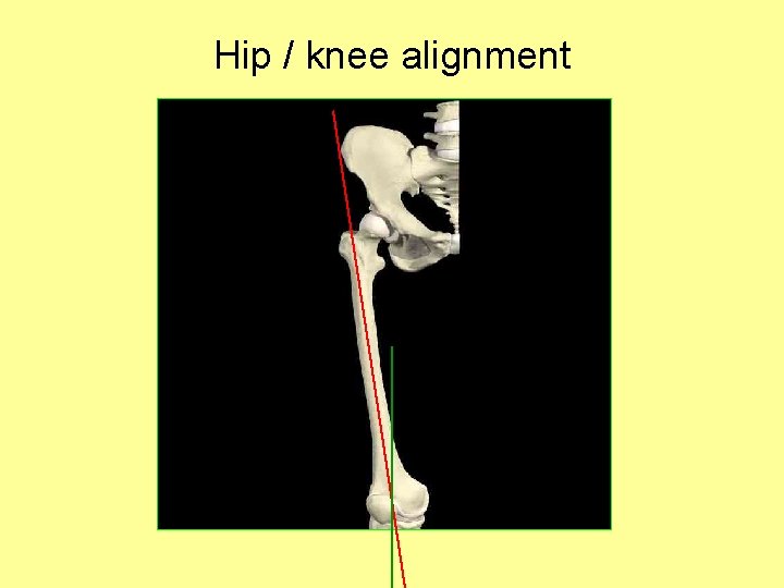 Hip / knee alignment 