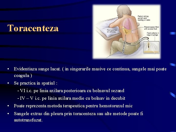 Toracenteza • Evidentiaza sange lacat. ( in singerarile masive ce continua, sangele mai poate