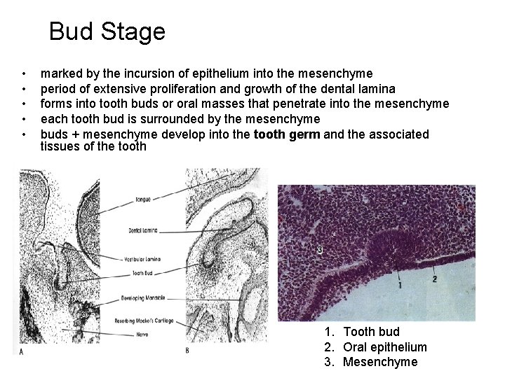 Bud Stage • • • marked by the incursion of epithelium into the mesenchyme