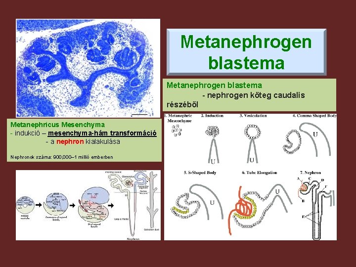 Metanephrogen blastema - nephrogen köteg caudalis részéből Metanephricus Mesenchyma - indukció – mesenchyma-hám transformáció