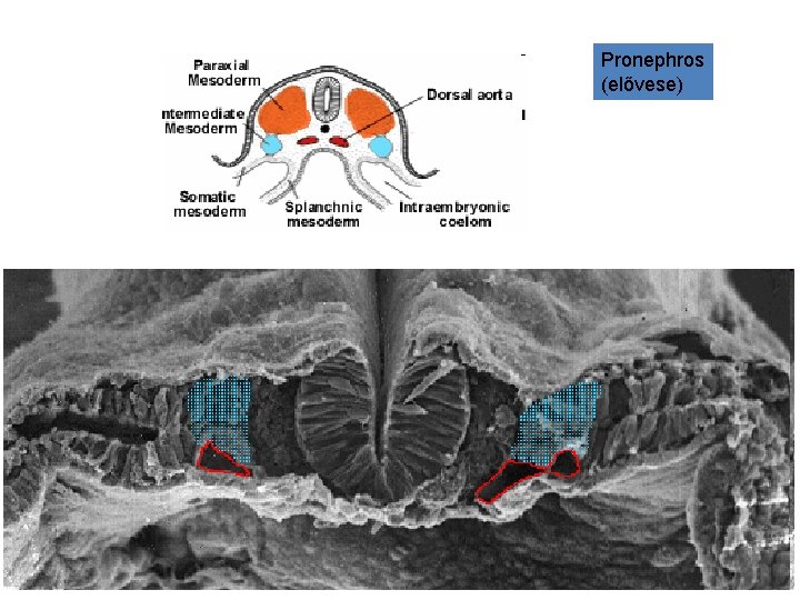 Pronephros (elővese) 