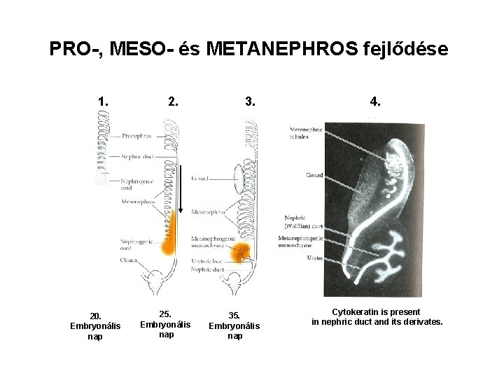 PRO-, MESO- és METANEPHROS fejlődése 1. 2. 3. 4. 20. Embryonális nap 25. Embryonális