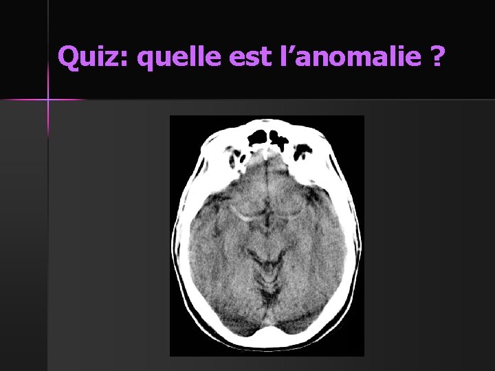 Quiz: quelle est l’anomalie ? 