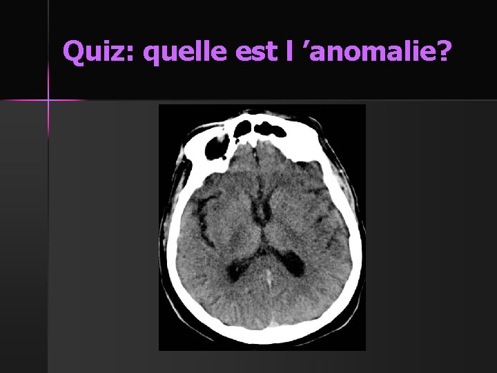 Quiz: quelle est l ’anomalie? 