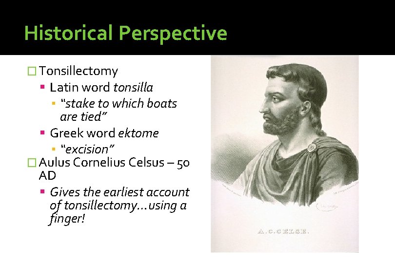 Historical Perspective � Tonsillectomy Latin word tonsilla ▪ “stake to which boats are tied”