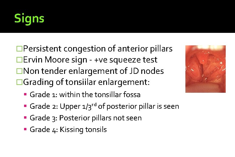 Signs �Persistent congestion of anterior pillars �Ervin Moore sign - +ve squeeze test �Non