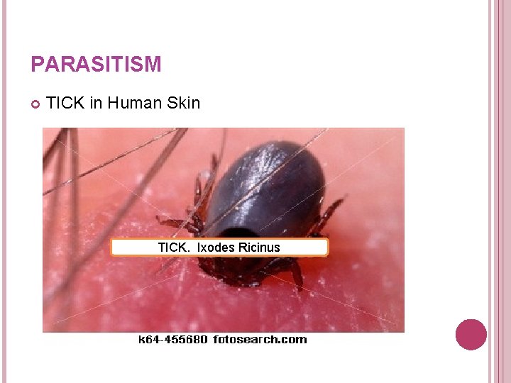 PARASITISM TICK in Human Skin TICK. Ixodes Ricinus PARASITISM TICK in Human Skin TICK. Ixodes Ricinus