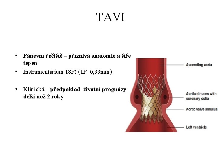 TAVI • Pánevní řečiště – příznivá anatomie a šíře tepen • Instrumentárium 18
