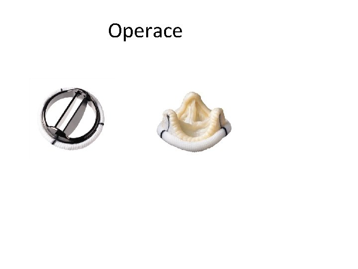 Operace 