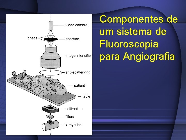 Componentes de um sistema de Fluoroscopia para Angiografia 