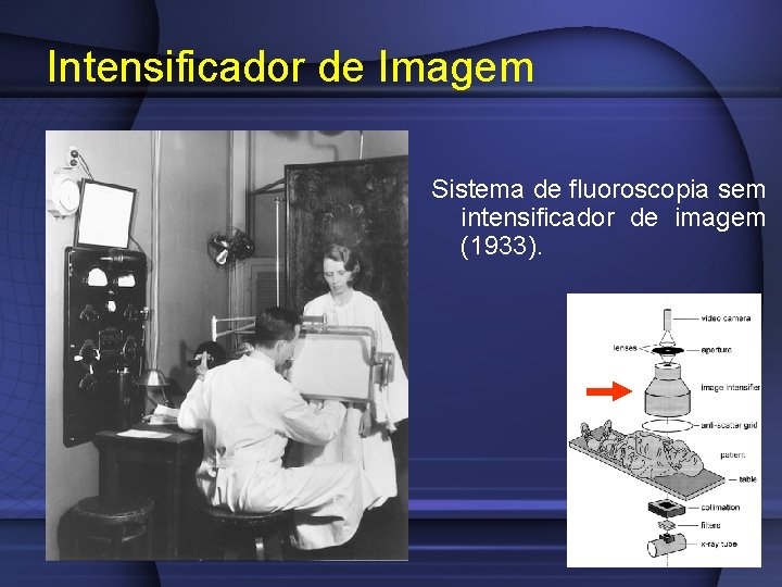 Intensificador de Imagem Sistema de fluoroscopia sem intensificador de imagem (1933). 
