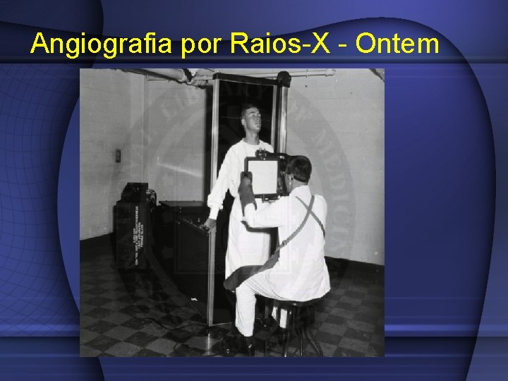 Angiografia por Raios-X - Ontem 