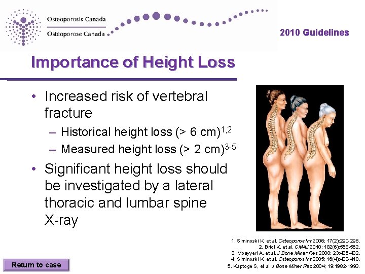 2010 Guidelines Importance of Height Loss • Increased risk of vertebral fracture – Historical 2010 Guidelines Importance of Height Loss • Increased risk of vertebral fracture – Historical