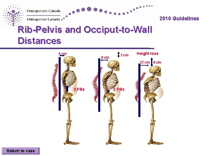 2010 Guidelines Rib-Pelvis and Occiput-to-Wall Distances 4 cm 8 cm 3 cm Height loss 2010 Guidelines Rib-Pelvis and Occiput-to-Wall Distances 4 cm 8 cm 3 cm Height loss