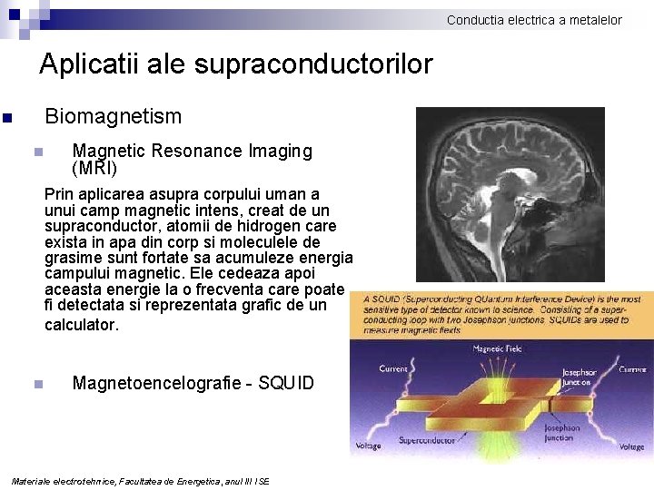 Conductia electrica a metalelor Aplicatii ale supraconductorilor n Biomagnetism n Magnetic Resonance Imaging (MRI)