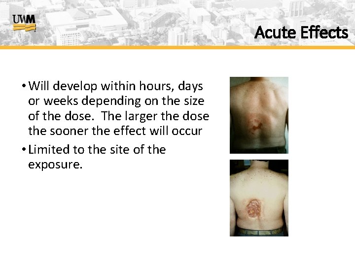 Acute Effects • Will develop within hours, days or weeks depending on the size