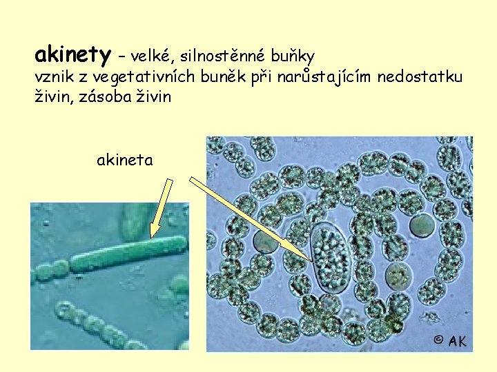 akinety – velké, silnostěnné buňky vznik z vegetativních buněk při narůstajícím nedostatku živin, zásoba