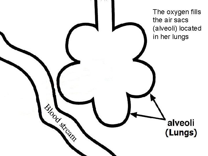 The oxygen fills the air sacs (alveoli) located in her lungs 