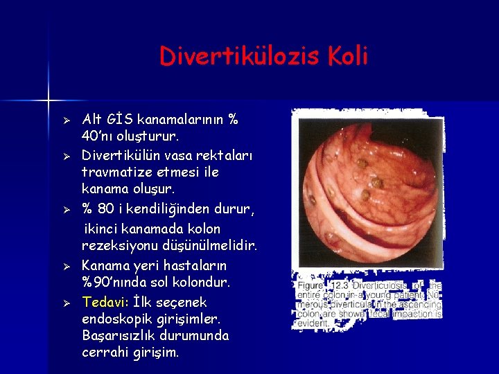 Divertikülozis Koli Ø Ø Ø Alt GİS kanamalarının % 40’nı oluşturur. Divertikülün vasa rektaları