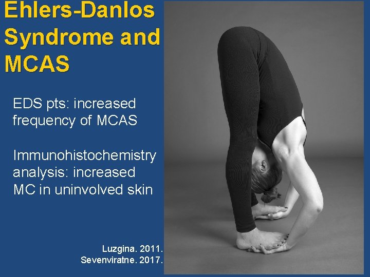 Ehlers-Danlos Syndrome and MCAS EDS pts: increased frequency of MCAS Immunohistochemistry analysis: increased MC