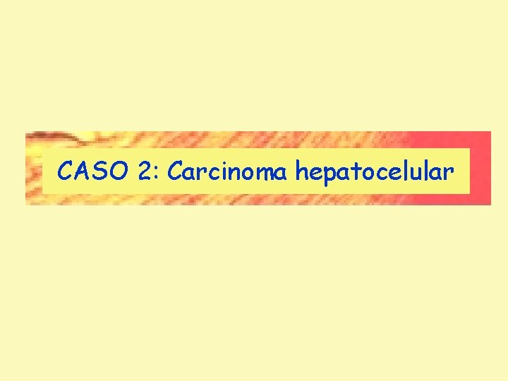 CASO 2: Carcinoma hepatocelular CASO 2: Carcinoma hepatocelular