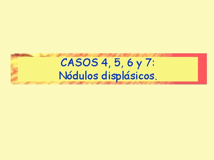 CASOS 4, 5, 6 y 7: Nódulos displásicos. CASOS 4, 5, 6 y 7: Nódulos displásicos.
