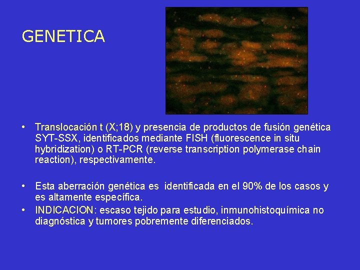 GENETICA • Translocación t (X; 18) y presencia de productos de fusión genética SYT-SSX,