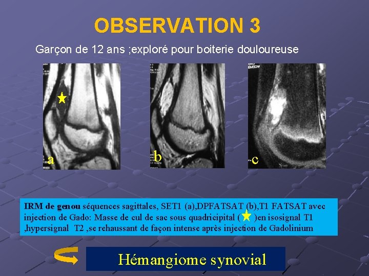 OBSERVATION 3 Garçon de 12 ans ; exploré pour boiterie douloureuse a b c
