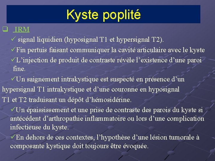 Kyste poplité q IRM ü signal liquidien (hyposignal T 1 et hypersignal T 2).