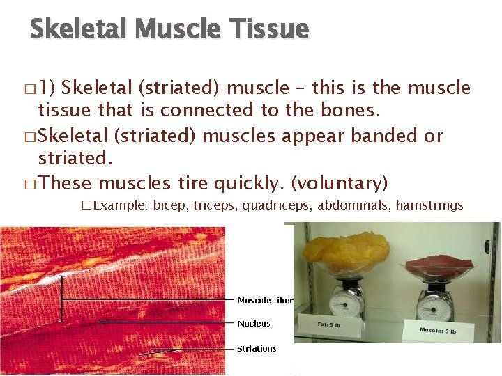 Skeletal Muscle Tissue � 1) Skeletal (striated) muscle – this is the muscle tissue