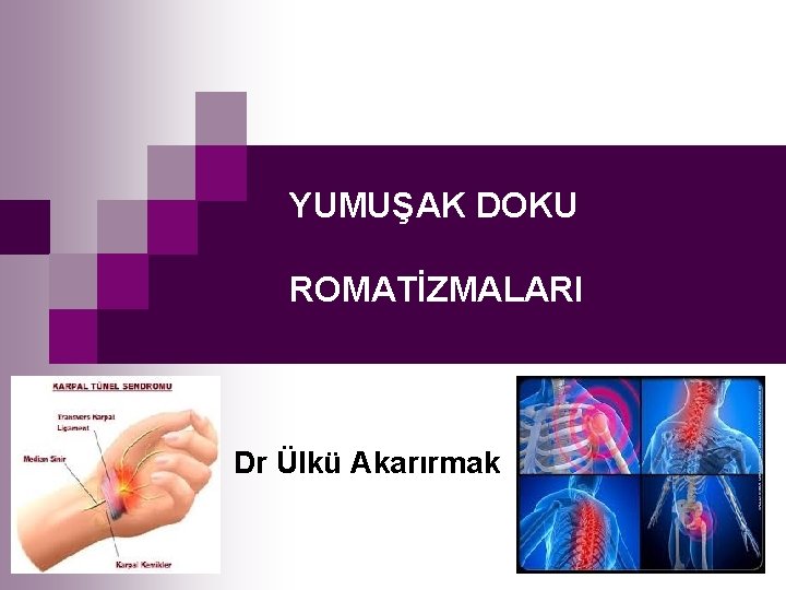 YUMUŞAK DOKU ROMATİZMALARI Dr Ülkü Akarırmak 