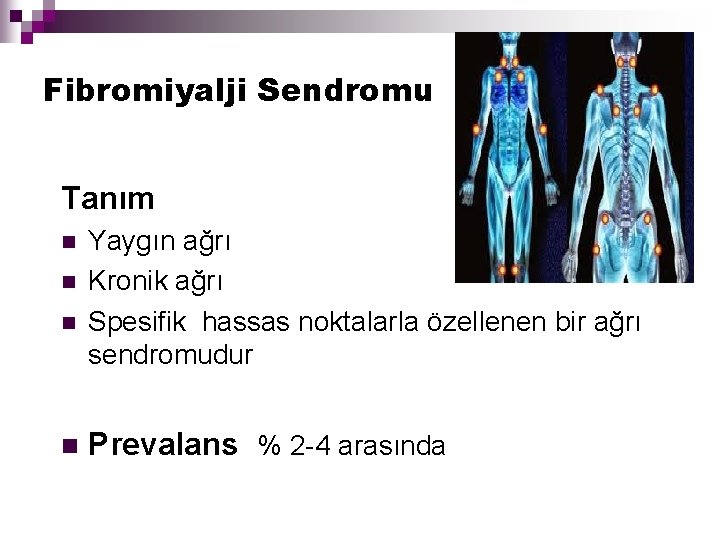 Fibromiyalji Sendromu Tanım n n Yaygın ağrı Kronik ağrı Spesifik hassas noktalarla özellenen bir