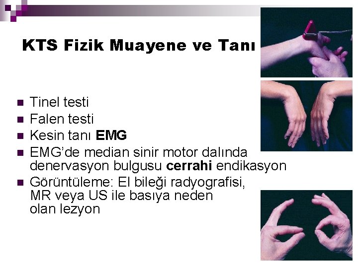 KTS Fizik Muayene ve Tanı n n n Tinel testi Falen testi Kesin tanı