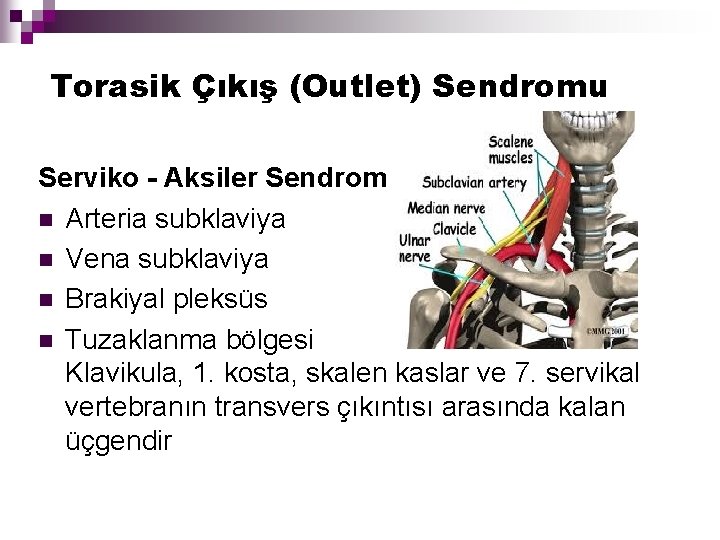 Torasik Çıkış (Outlet) Sendromu Serviko - Aksiler Sendrom n Arteria subklaviya n Vena subklaviya